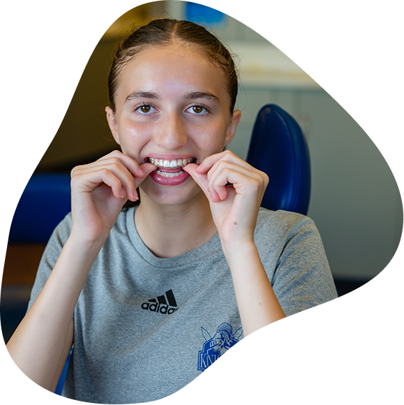 Young Female Cook Orthodontics Patient Putting In Clear Aligner